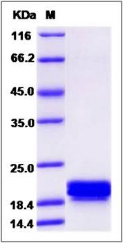 SDS-PAGE analysis of human CNPY2 protein (His Tag)