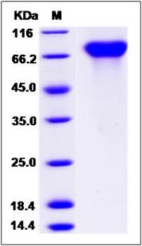 SDS-PAGE analysis of Human PROS1 protein (His Tag)