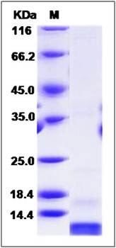 SDS-PAGE analysis of mouse S100A4 protein