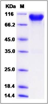 SDS-PAGE analysis of Cynomolgus FGFR4 protein