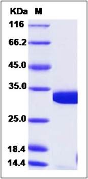 SDS-PAGE analysis of human COASY protein (His Tag)