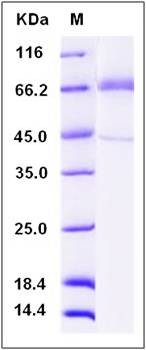 SDS-PAGE analysis of human TLR4 protein (His Tag)