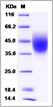 SDS-PAGE analysis of human CD58 protein (His Tag)