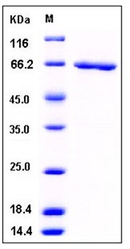 SDS-PAGE analysis of human SerpinB2 GST tag protein