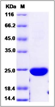 SDS-PAGE analysis of Human PPCDC protein (His Tag)