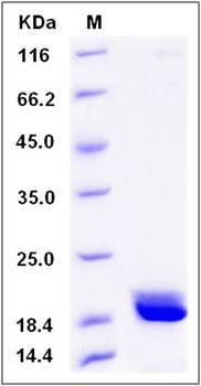 SDS-PAGE analysis of human CABP3 protein (His Tag)