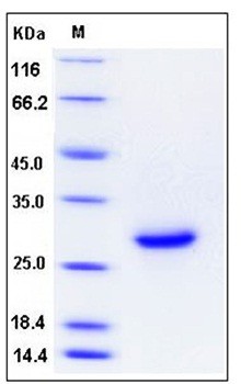 SDS-PAGE analysis of Mouse SDC4 His tag protein