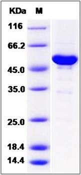 SDS-PAGE analysis of Human NAA10 protein (GST Tag)