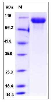 SDS-PAGE analysis of mouse EGFR protein (His Tag)