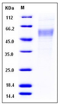 SDS-PAGE analysis of Human PLA2G7 His tag protein