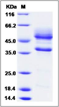 SDS-PAGE analysis of PRAP1 protein