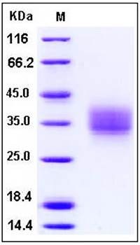SDS-PAGE analysis of mouse Frizzled 1 His tag protein