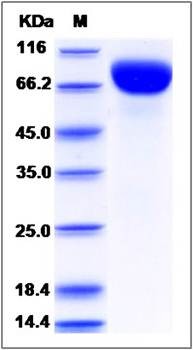 SDS-PAGE analysis of human Biotinase protein (His Tag)