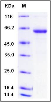 SDS-PAGE analysis of human ERP27 protein