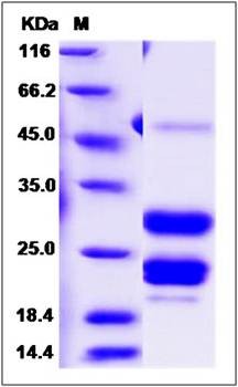 SDS-PAGE analysis of human AGA protein (His Tag)