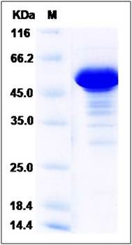 SDS-PAGE analysis of Human NCKIPSD protein (GST Tag)