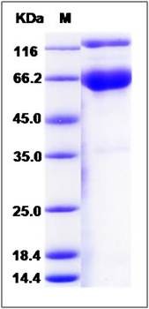 SDS-PAGE analysis of Human PROCR protein