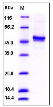 SDS-PAGE analysis of human CSNK1G2 His tag protein