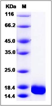 SDS-PAGE analysis of human GADD45G protein (Native)