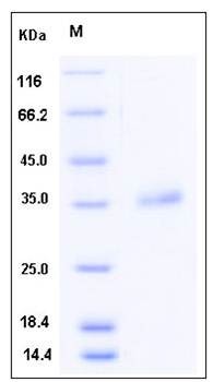 SDS-PAGE analysis of Human IGFBP7 protein (His Tag)