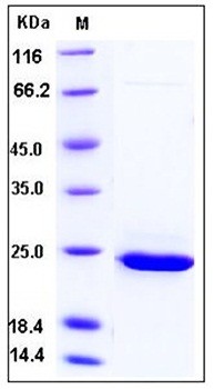 SDS-PAGE analysis of Human PRDX1 His tag protein