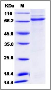 SDS-PAGE analysis of human BTK protein (His Tag)