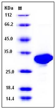SDS-PAGE analysis of mouse CA2 His tag protein