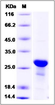 SDS-PAGE analysis of Human MID1IP1 protein (His Tag)