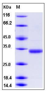 SDS-PAGE analysis of human CMA1 protein (His Tag)