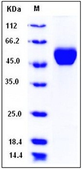 SDS-PAGE analysis of Human LUM His tag protein