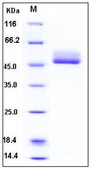 SDS-PAGE analysis of human B4GALT1 His tag protein