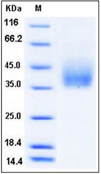 SDS-PAGE analysis of rat GHR His tag protein