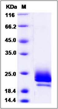 SDS-PAGE analysis of Human MZB1 protein (His Tag)