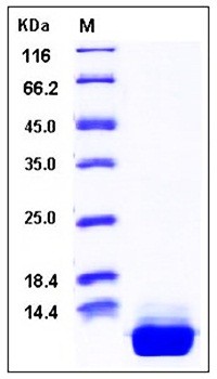 SDS-PAGE analysis of Human S100A10 His tag protein