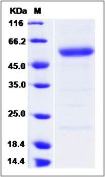 SDS-PAGE analysis of PRELP protein