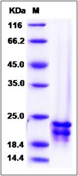 SDS-PAGE analysis of human FGF17 protein (Native)