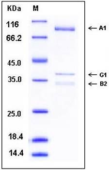 SDS-PAGE analysis of human AMPK protein