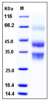 SDS-PAGE analysis of mouse CLU His tag protein