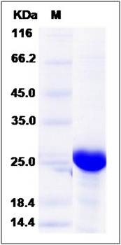 SDS-PAGE analysis of human ECSIT protein (His Tag)