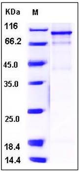 SDS-PAGE analysis of human FES His GST tag protein