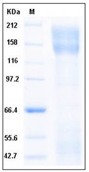 SDS-PAGE analysis of human CD171 His tag protein