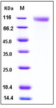 SDS-PAGE analysis of Human SCARB1 Fc His tag protein