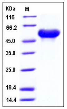 SDS-PAGE analysis of mouse ARSA His tag protein