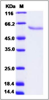 SDS-PAGE analysis of Sus scrofa Legumain (His Tag) protein