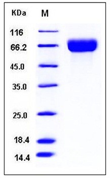 SDS-PAGE analysis of human SLC3A2 His tag protein