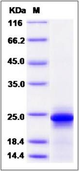 SDS-PAGE analysis of Mouse IL6 protein (Native)