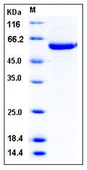 SDS-PAGE analysis of human STK4 His tag protein
