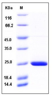 SDS-PAGE analysis of Human RAC2 His tag protein