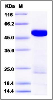 SDS-PAGE analysis of human DARS protein (His Tag)