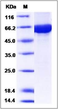 SDS-PAGE analysis of human CBLC protein (GST Tag)
